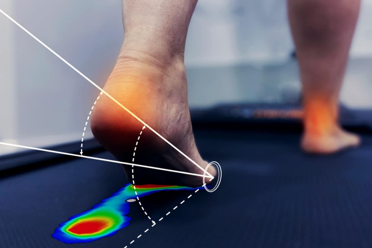 Podología deportiva